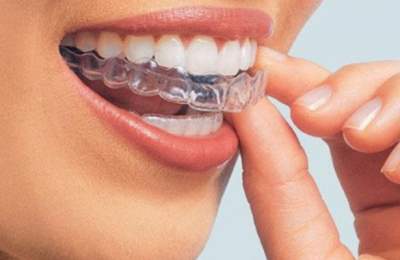 Стоматологи назвали самые главные мифы о зубах