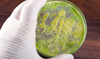 Медики предупредили об угрозе супербактерии, вызывающей бесплодие