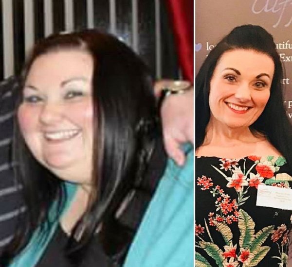 Потерявшая 108 килограммов женщина поделилась секретами похудения