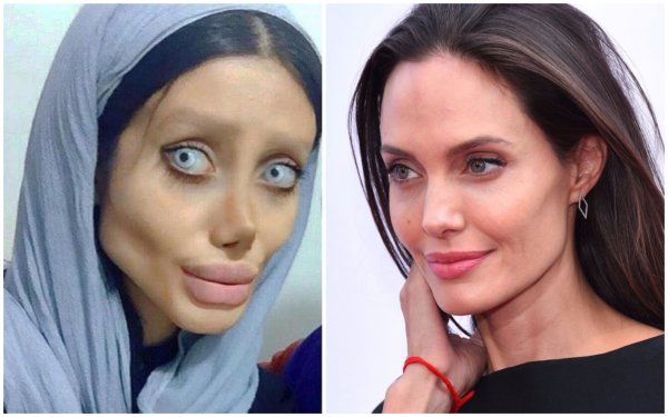 «Зомби-копия» Анджелины Джоли сделала новую операцию ради схожести с кумиром